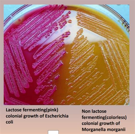 macconkey agar ingredients|macconkey agar quizlet.
